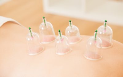 Revolutionize Your Wellness with Cupping Therapy in Minnetonka, MN